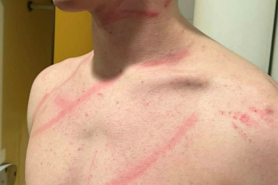 Jadran Kostrena na svojoj stranci objavio ovu fotku nakon derbija